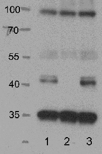 SnRK2,2, SnRK2,3, SnRK2,6 | Ser/Thr-protein kinase SnRK in the group Antibodies Plant/Algal  / Developmental Biology / Signal transduction at Agrisera AB (Antibodies for research) (AS14 2783)